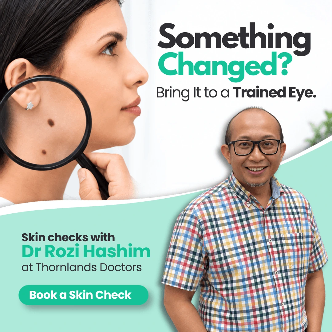 Skin check with Dr Rozi popup image
